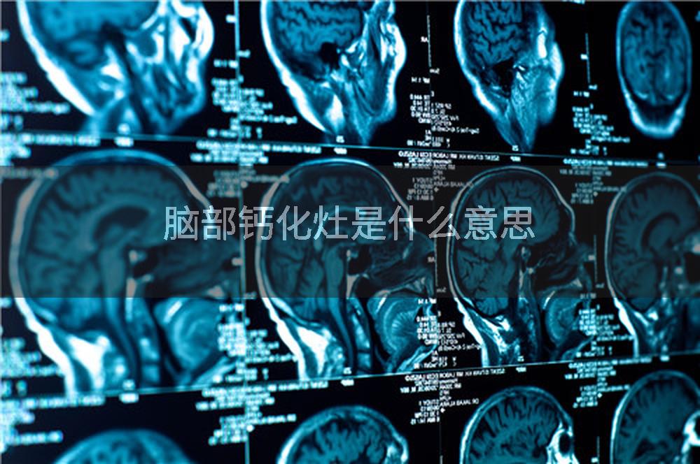 脑部钙化灶是什么意思