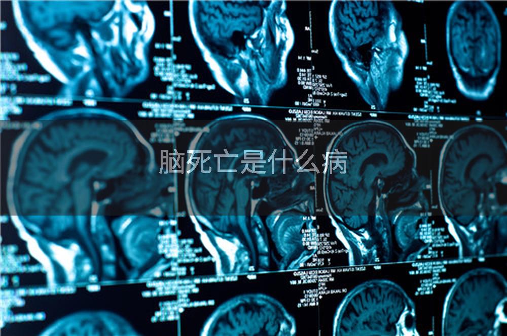 脑死亡是什么病