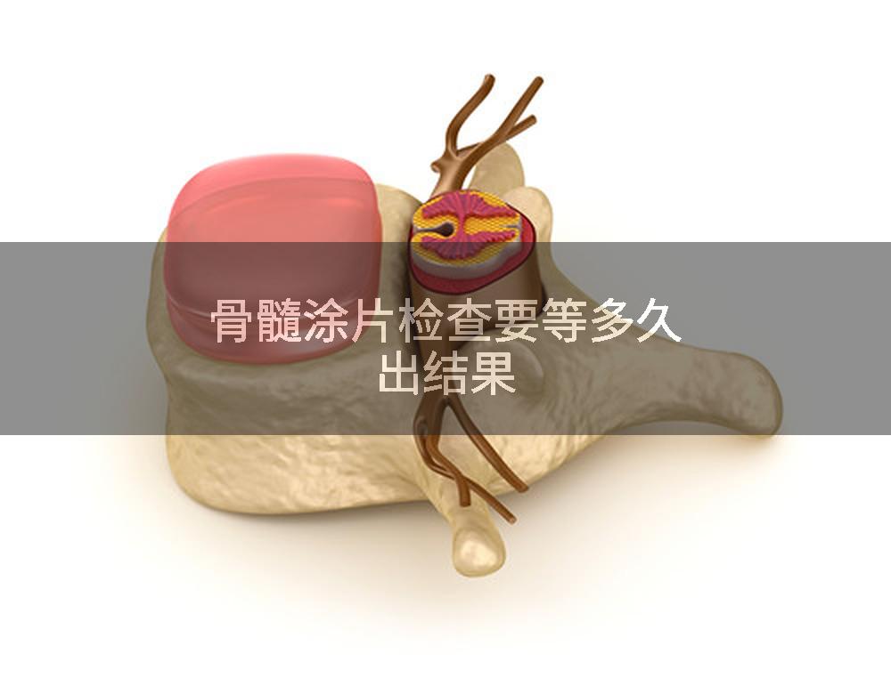 骨髓涂片检查要等多久出结果