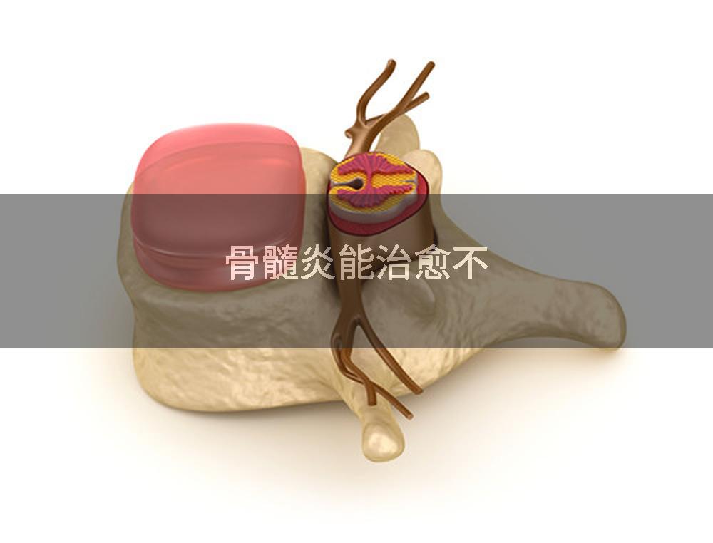 骨髓炎能治愈不