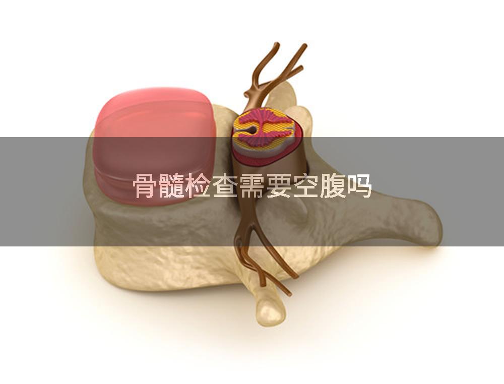 骨髓检查需要空腹吗