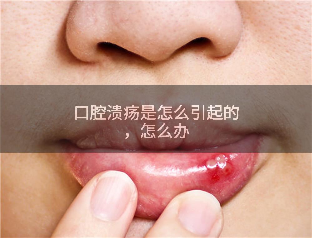 口腔溃疡是怎么引起的，怎么办