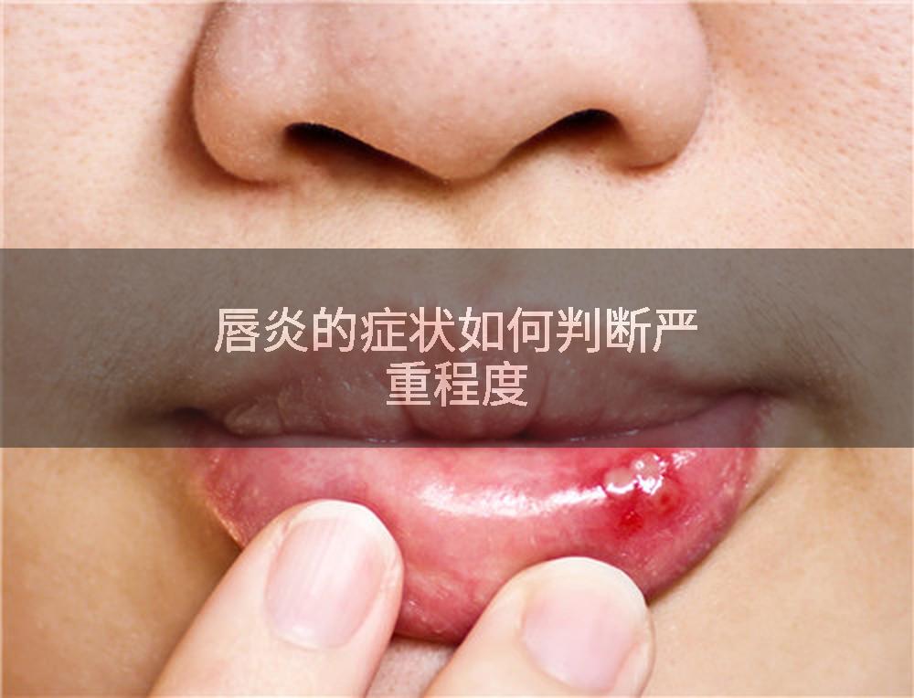 唇炎的症状如何判断严重程度