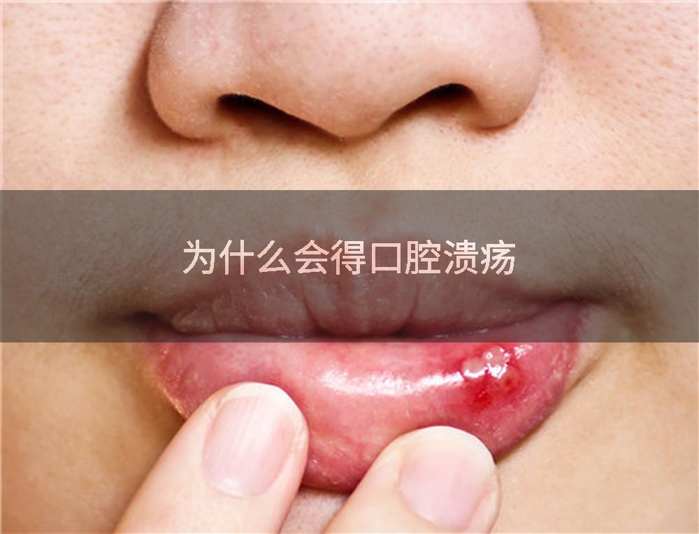 为什么会得口腔溃疡
