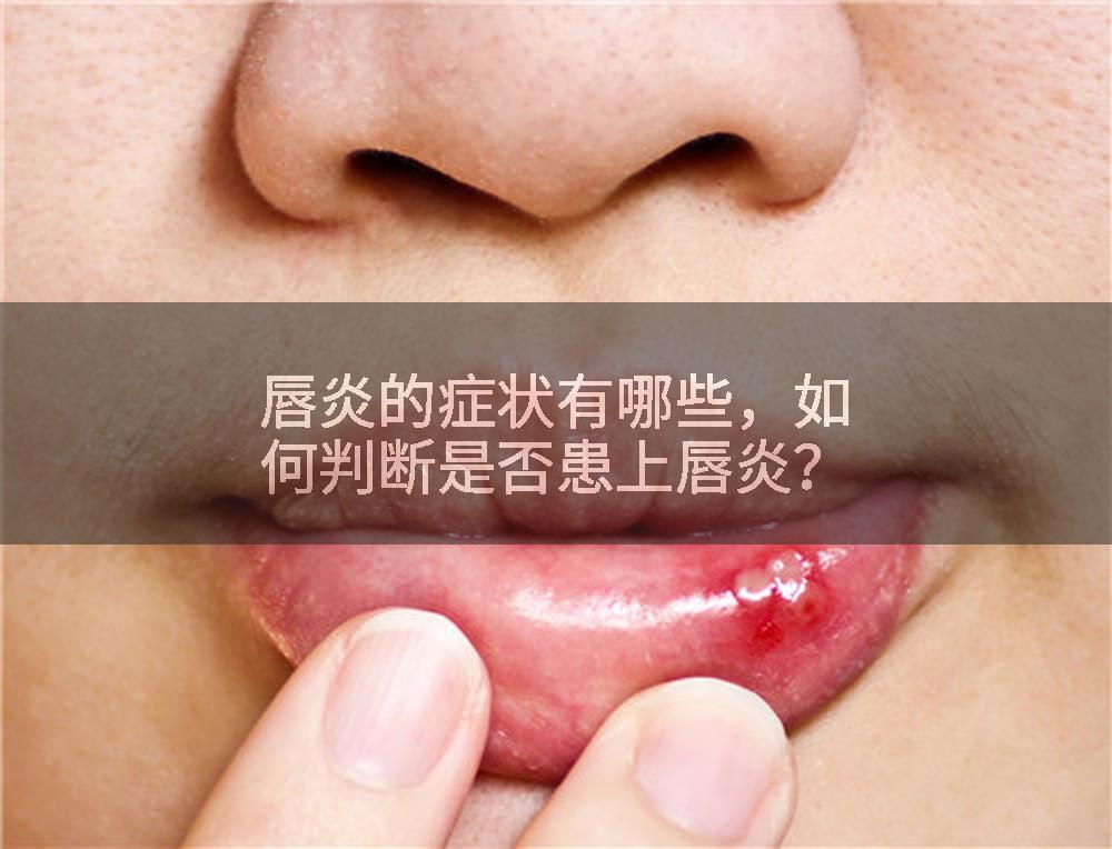 唇炎的症状有哪些，如何判断是否患上唇炎？