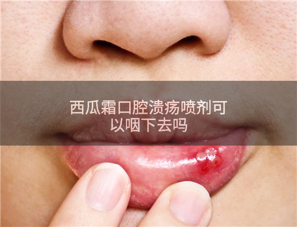 西瓜霜口腔溃疡喷剂可以咽下去吗