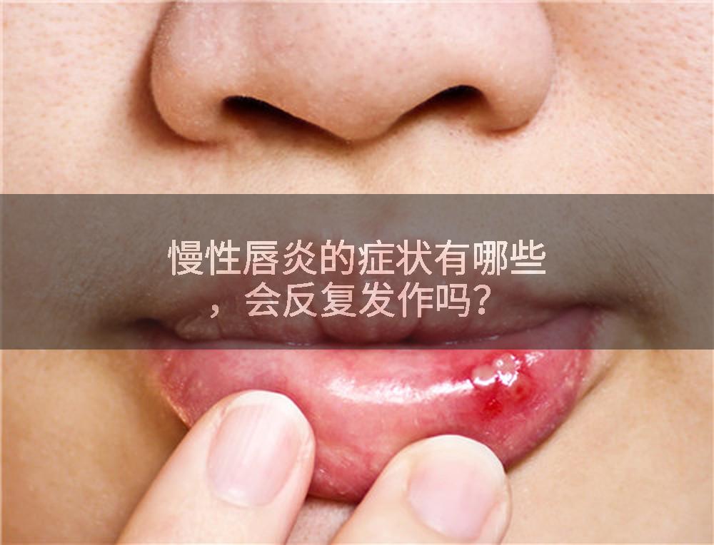 慢性唇炎的症状有哪些，会反复发作吗？