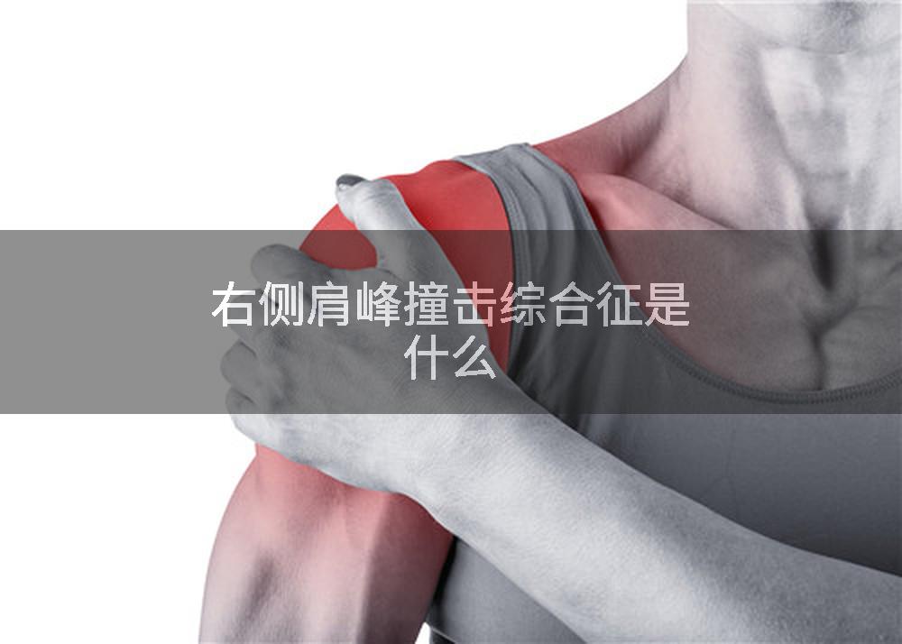 右侧肩峰撞击综合征是什么