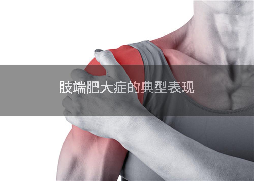 肢端肥大症的典型表现