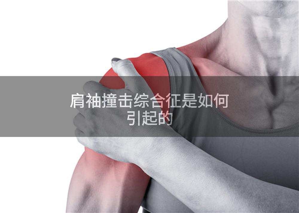 肩袖撞击综合征是如何引起的