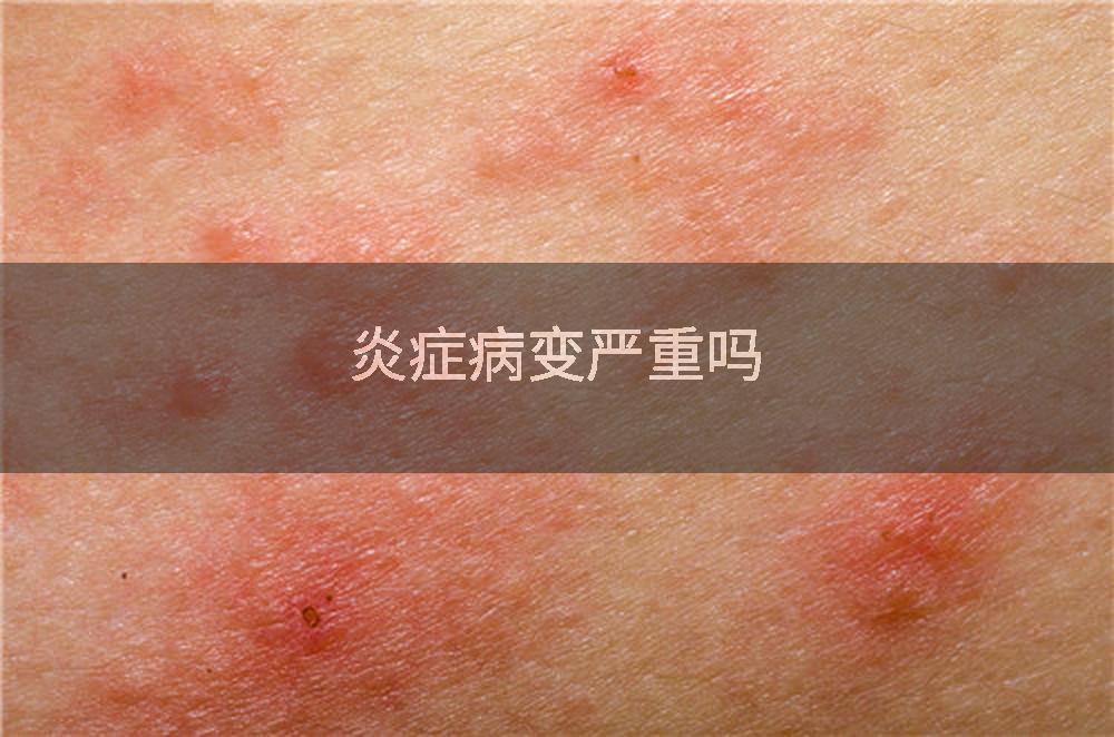 炎症病变严重吗