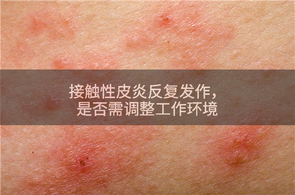 接触性皮炎反复发作，是否需调整工作环境