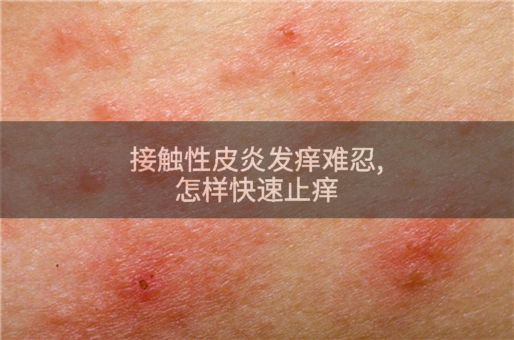 接触性皮炎发痒难忍,怎样快速止痒