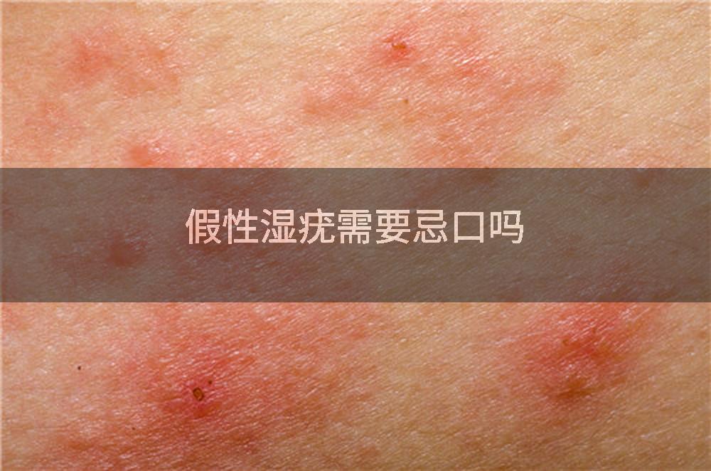 假性湿疣需要忌口吗