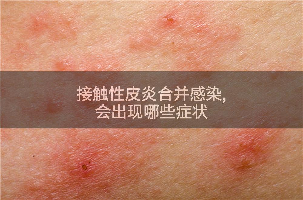 接触性皮炎合并感染,会出现哪些症状