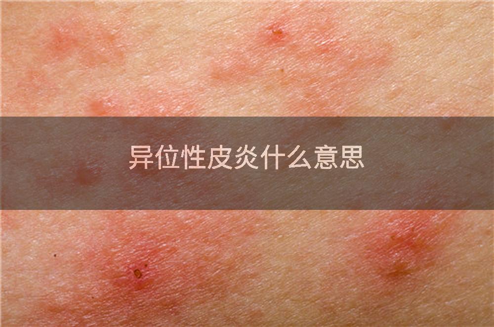 异位性皮炎什么意思