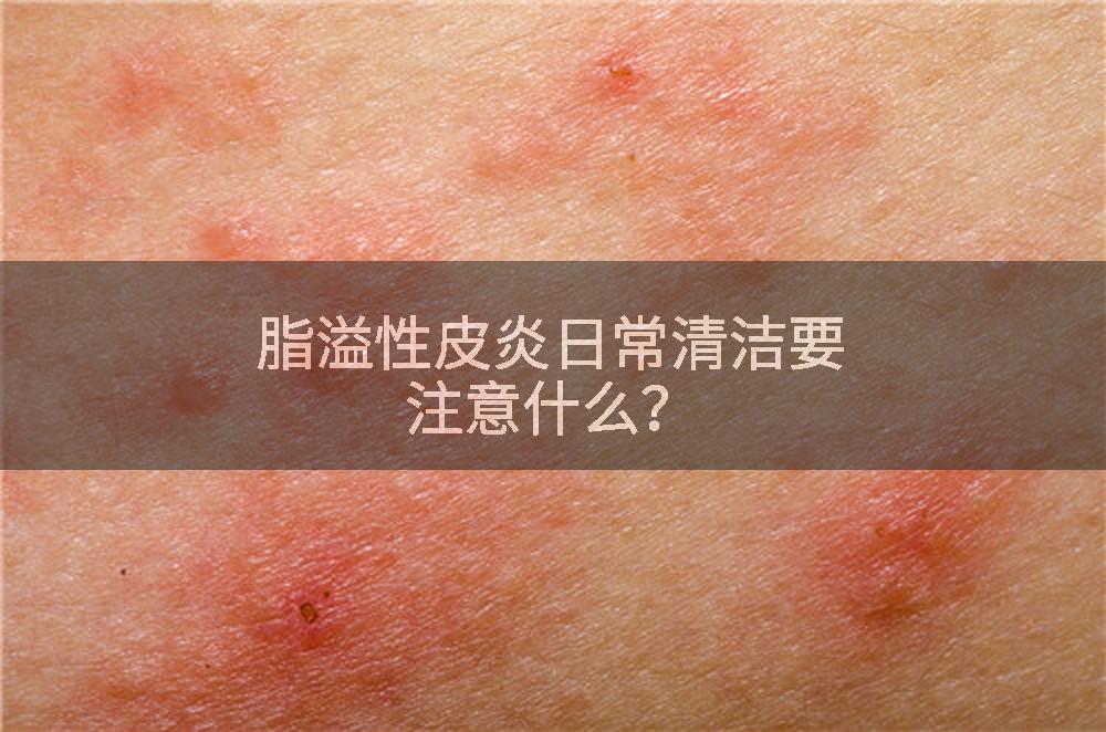 脂溢性皮炎日常清洁要注意什么？