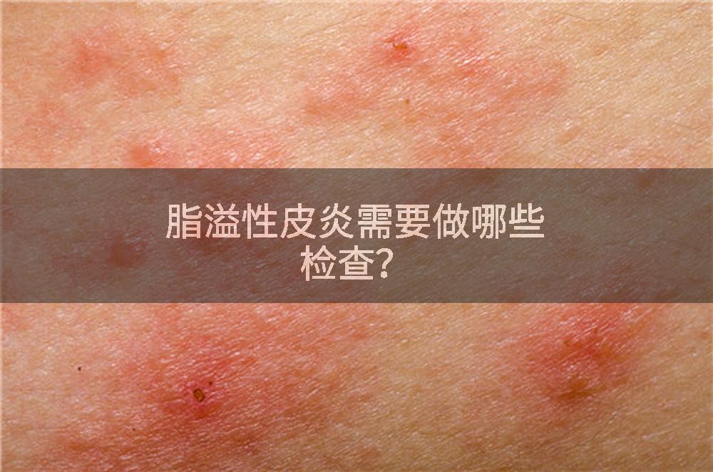 脂溢性皮炎需要做哪些检查？