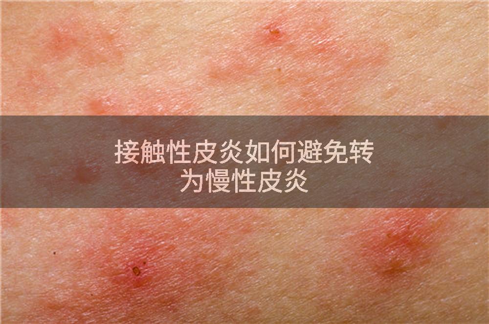 接触性皮炎如何避免转为慢性皮炎