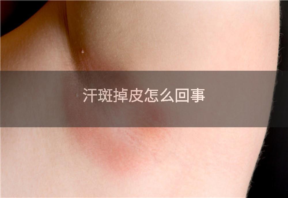 汗斑掉皮怎么回事
