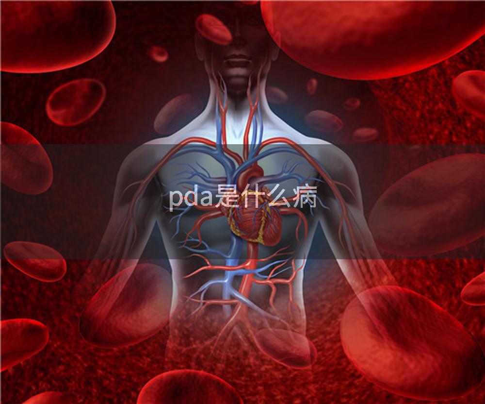 pda是什么病