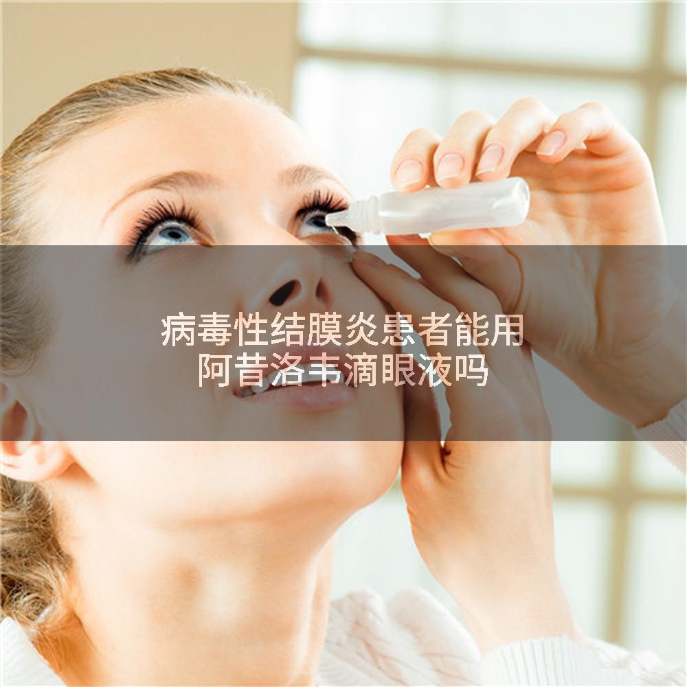 病毒性结膜炎患者能用阿昔洛韦滴眼液吗