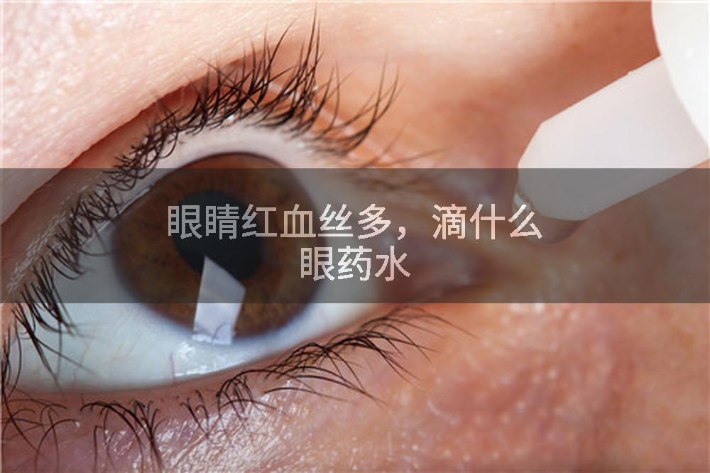 眼睛红血丝多，滴什么眼药水