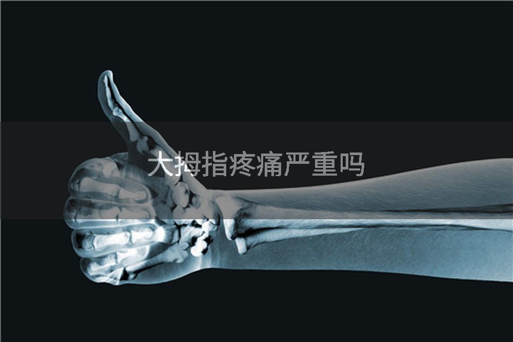 大拇指疼痛严重吗