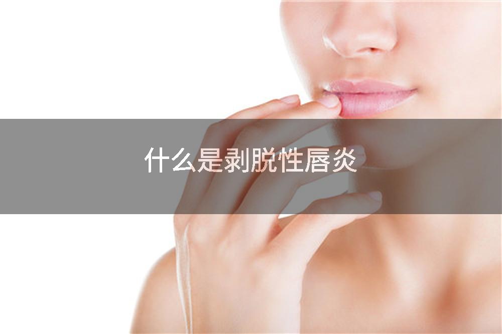 什么是剥脱性唇炎