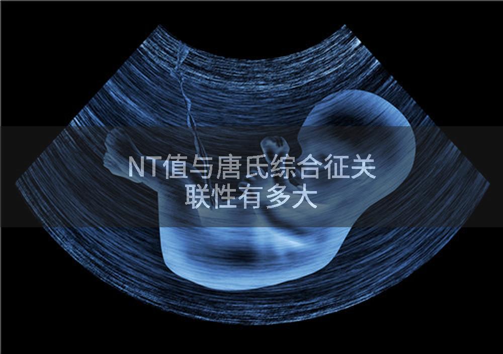 NT值与唐氏综合征关联性有多大