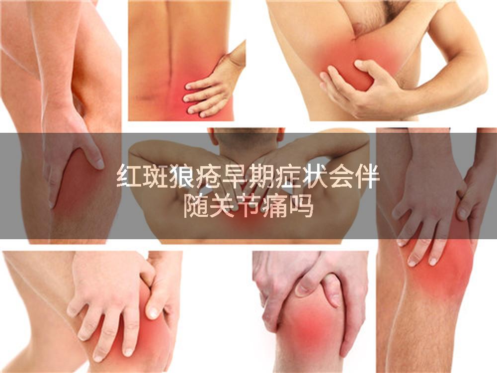 红斑狼疮早期症状会伴随关节痛吗