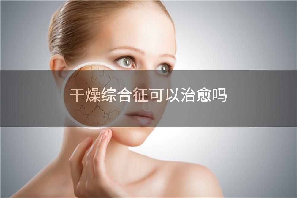 干燥综合征可以治愈吗