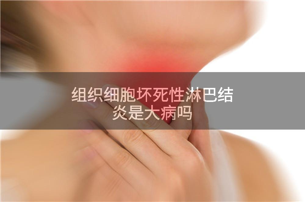 组织细胞坏死性淋巴结炎是大病吗