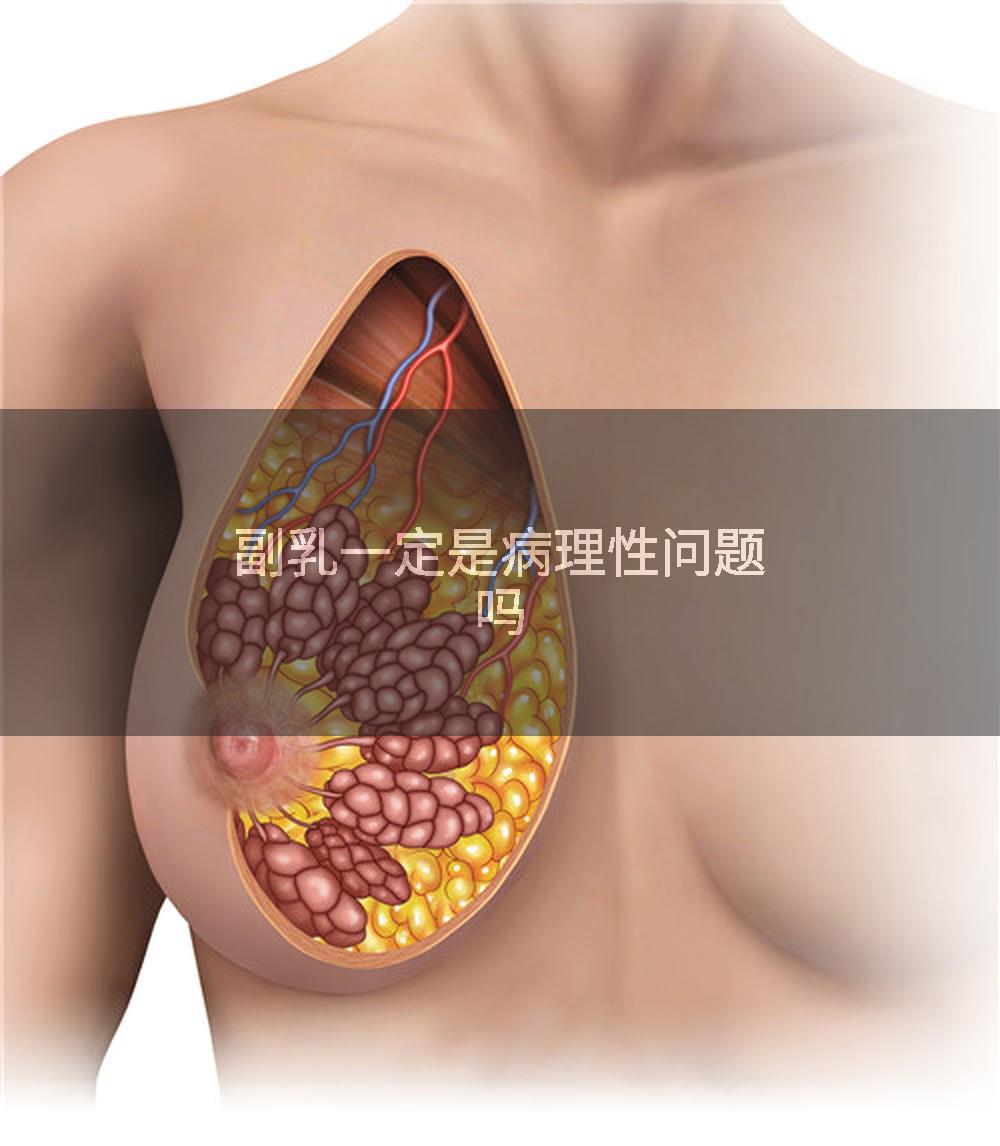 副乳一定是病理性问题吗