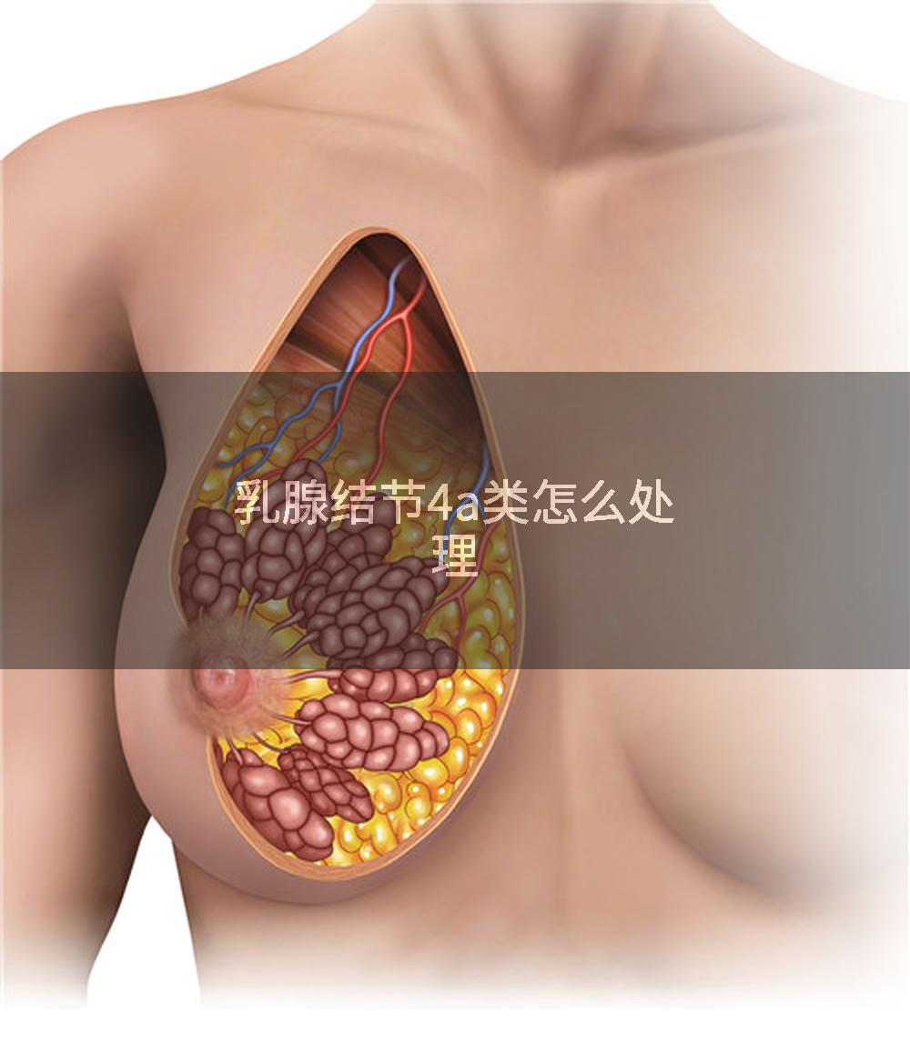 乳腺结节4a类怎么处理