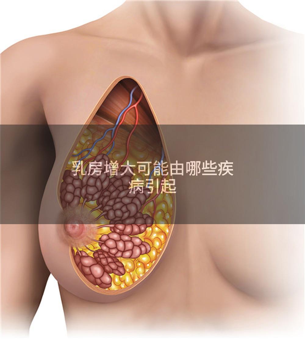 乳房增大可能由哪些疾病引起