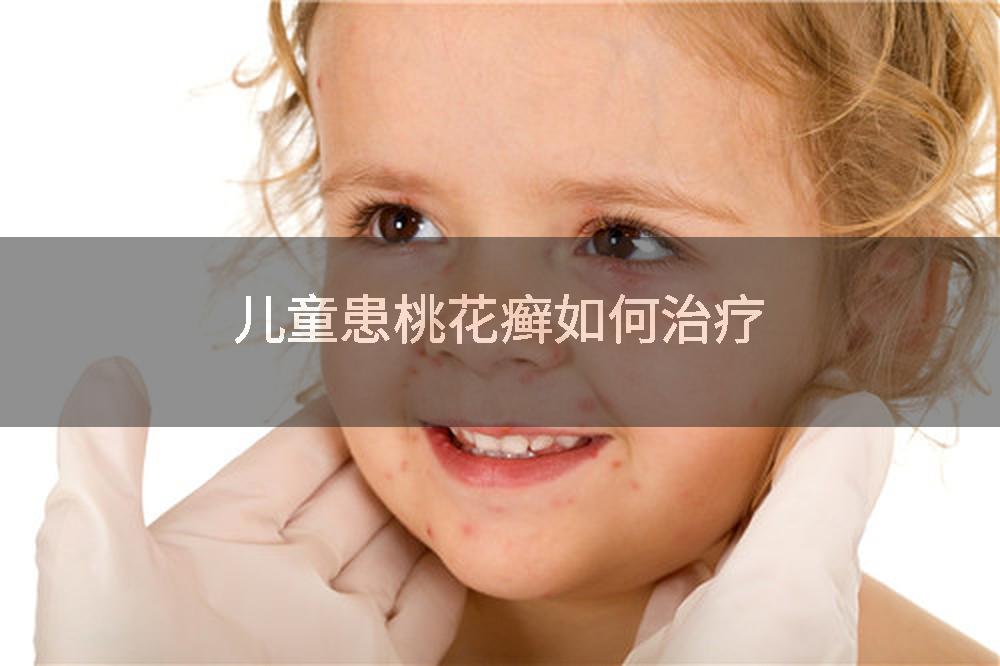儿童患桃花癣如何治疗