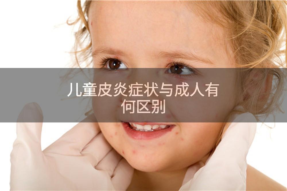 儿童皮炎症状与成人有何区别