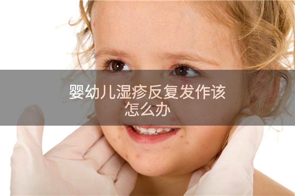 婴幼儿湿疹反复发作该怎么办