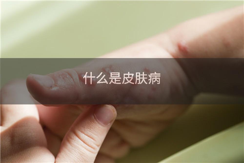 什么是皮肤病