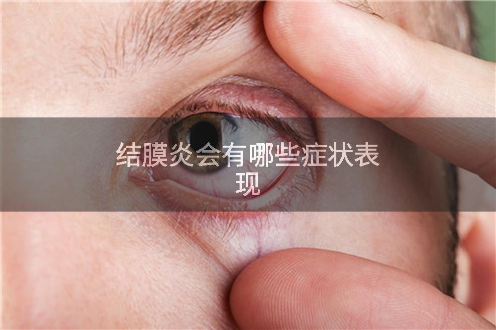 结膜炎会有哪些症状表现