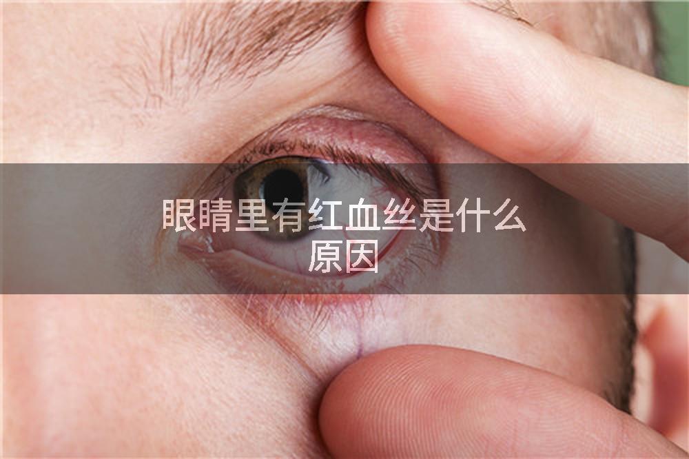 眼睛里有红血丝是什么原因