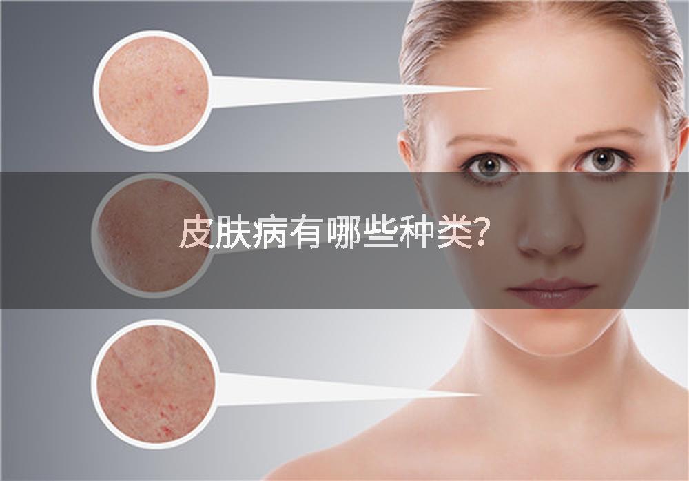 皮肤病有哪些种类？