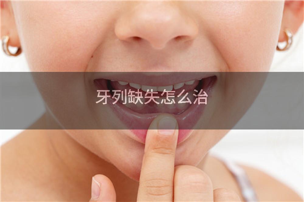 牙列缺失怎么治