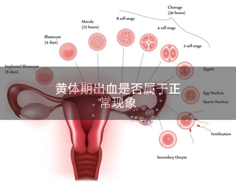 黄体期出血是否属于正常现象