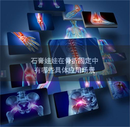 石膏娃娃在骨折固定中有哪些具体应用场景