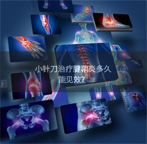 小针刀治疗腱鞘炎多久能见效?