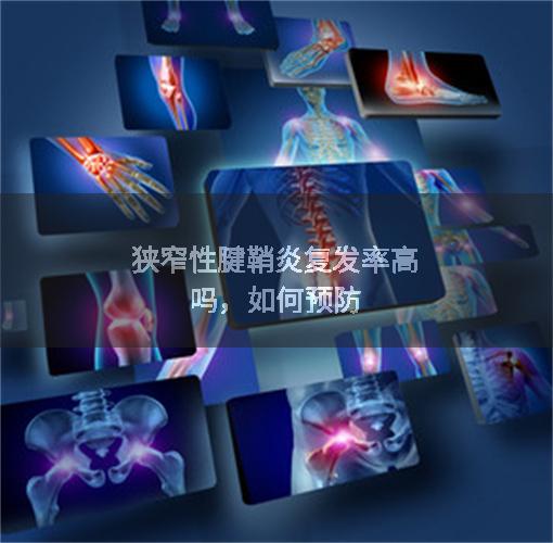 狭窄性腱鞘炎复发率高吗,如何预防