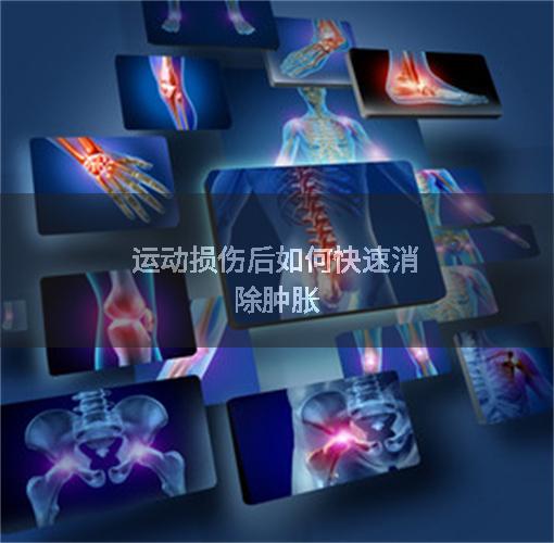 运动损伤后如何快速消除肿胀