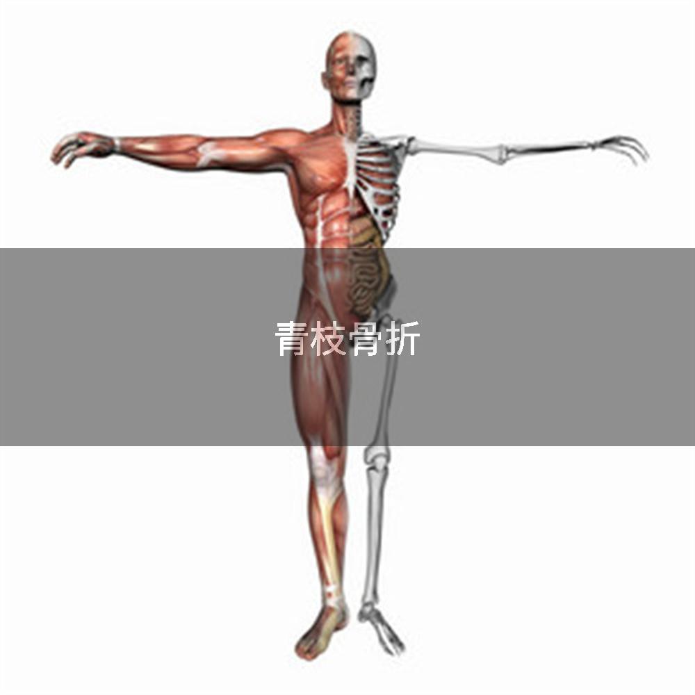 青枝骨折